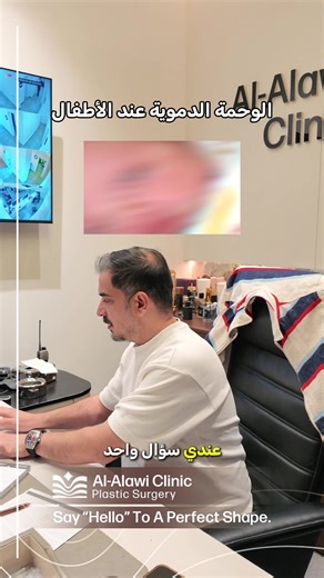 وحمة دموية عند طفل حديث الولادة… هل تحتاج علاج⁉️ المعاينات⬇️ الاحد و الثلاثاء و الخميس هواتف الحجز ☎️ 07755444655 07712288872 د محمد العلوي اخصائي جراحة تجميلية و تقويمية بورد عربي -دكتوراه- د رامية الساعدي اخصائية جراحة تجميلية و تقويمية بورد عربي - دكتوراه - رأيكم يهمنا ❤️ #تجميل_طبيعي_آمن ✅⁩⁩⁩⁩⁩⁩⁩⁩⁩⁩⁩⁩⁩⁩⁩⁩⁩⁩⁩⁩⁩⁩⁩⁩⁩⁩⁩⁩⁩⁩⁩⁩⁩⁩