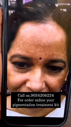 13 reactions | Call us.9034206224 for order online your pigmentation treatment kit at home #trendingreels #reelsfb #facebookreels #nishalambha #explorepage #instagood #bodywhitening #facialskincare | Nisha Lambha - Sparsh Beauty Care & Hair Treatment LLP 5 | Facebook