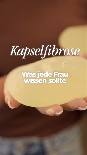 Brustverhärtung nach der OP? Das solltest du wissen. 🛑 Deine Brust fühlt sich plötzlich fest an oder verändert ihre Form? Das ist ein Thema, über das viel zu wenig gesprochen wird. Es könnte eine Kapselfibrose dahinterstecken. Ich erkläre dir im Video, warum dein Körper diese Reaktion zeigt, was genau dabei passiert und ab wann du handeln solltest. Schau es dir an, um die Anzeichen richtig zu deuten. ✨👩‍⚕️ 🌐 Alle Infos & Termine: www.alsergrund-aesthetics.at #kapselfibrose #brustop #brustverg