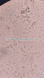 88K views · 1.7K reactions | Stool sample ❤️ #medicallaboratoryscience #Microbiology #hematology #clinicalchemistry | Lab life | Facebook