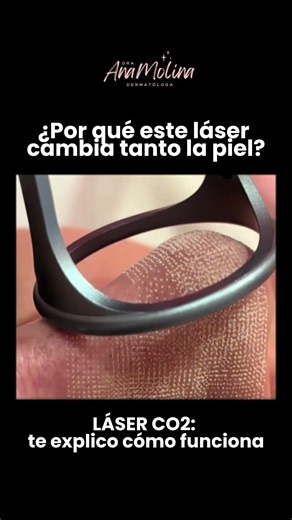 Laser C02 ¿Cómo funciona? 🚨
