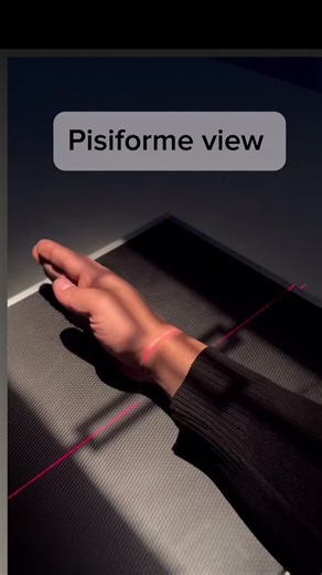 #radiologist #radiologytechnologist #radiology #radtechstudent #viraltiktok