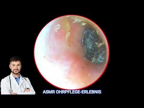 ASMR Ohrpflege-Erlebnis / Unlock Tranquility: An Informative Guide to ASMR Ear Care Techniques!