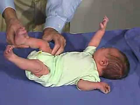 physical exam -Newborn Normal: Tone-Popliteal Angle