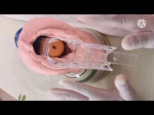 Técnica citología vaginal.