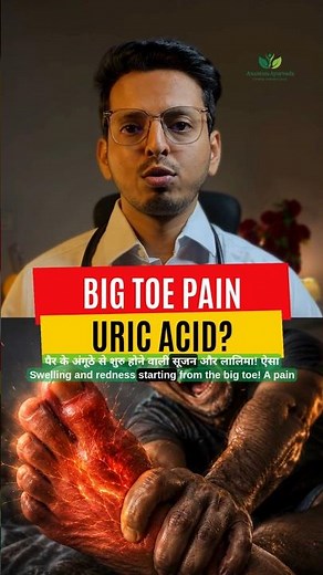 Uric Acid Symptoms in Legs & Joints? | Gout Pain Relief Ayurvedic Remedy | High Uric Acid Treatment