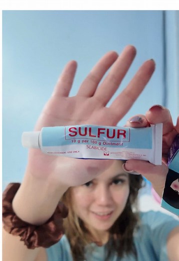 Effective Dandruff Treatment with Dr. S. Wong’s Ointment