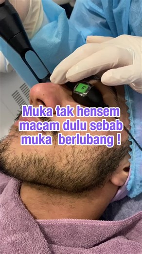 Non-Invasive Skin Treatments at Laser & Light Skin Centre