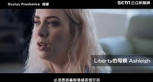 義眼（眼用補綴物）：手術、ケア、種類 - 目の健康 2026