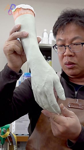 의수 제작 과정의 모든 것