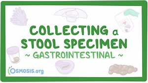 Gastrointestinal: Collecting a stool specimen (for nursing assistant training): Video, Causes, & Meaning | Osmosis