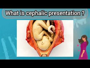 Cephalic presentation in normal delivery✔📈