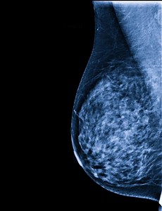 3D Mammography Testing Services, Mammogram Screening Buffalo, Springville, Hamburg & Orchard Park NY