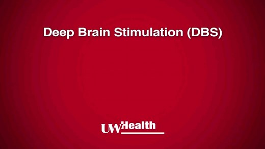 【Deep Brain Stimulation】<中英字幕>DBS脑起搏器/脑深部刺激是什么？