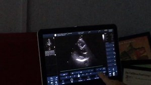 Testing our new GE Vivid IQ touchscreen Echo machine. | Heart Foundation Jamaica