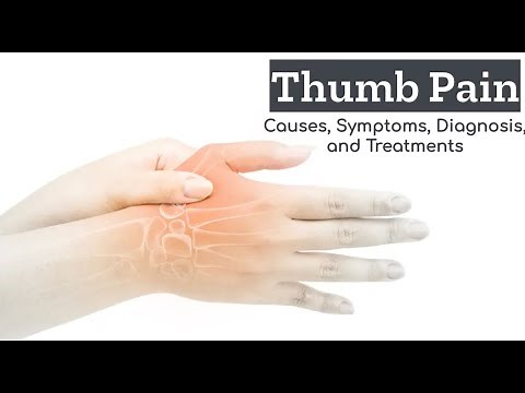 Thumb Pain Explained: What's Ailing Your Thumbs?