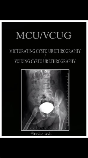 X-RAY TECH....🩻 on Instagram: "➡️MCU-MICTURATINGCYSTOURETHROGRY ➡️VCU- VOIDING CYSTOURETHROGRAPHY 🩻MCU is radiographic study of the lower urinary tract (Urethra or, Bladder).. .. #like#share#follow FOLLOW- @radio_tech___ #XrayTechnician #Radiology #Medicallmaging #XrayVision #RadiologicTechnologist #HealthcareProfessional #MedicalField #DiagnosticImaging #Xraylmage #radiologylife #Instagramgrowth#Explore #Igreach #ınstagramhacks"