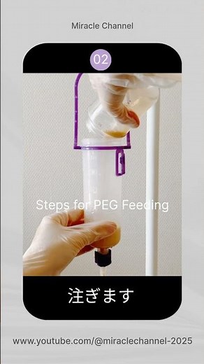胃ろう注入手順／ G-Tube Feeding Flow & How to set up Amika #medicalcare