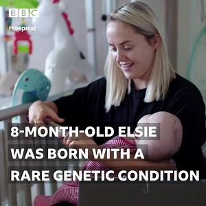 3.7M views · 329 reactions | Baby Elsie suffers from a rare chromosomal condition never seen before in Alder Hey Children’s Hospital, and has had to undergo 11 operations in 8 months. | BBC | Facebook