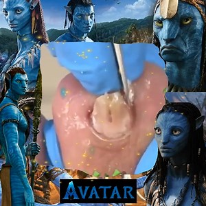 Episode My love watch ❤️ | Amazing Meme