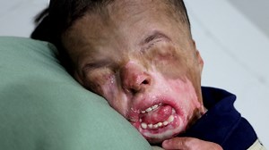 Ja’Bari was born without skin and was not expected to survive. After beating all odds, he had skin grafts grown for him in a lab. Ja’Bari is now four years old and a bit delayed because he spent his first few years just fighting to live. Ja’Bari’s mom hopes others treat her son like the fun-loving child he is even though he may look and act different. | Special Books by Special Kids