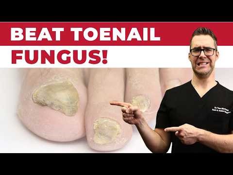 Top Toenail Fungus Treatments Doctors Recommend [+4 Tips] 2026