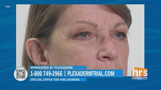 HRS: Look your best with Plexaderm