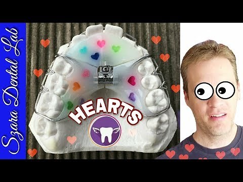 How to make a Retainer with Hearts lesson by Szara dental