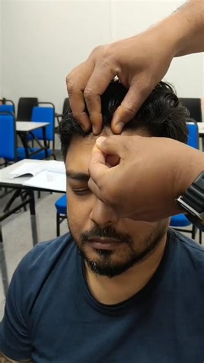 GV24, or Shenting (Spirit Court), is a crucial acupuncture point on the Governing Vessel meridian, found on the midline of the head, about half an inch (0.5 cun) into the hairline at the center, used for anxiety, insomnia, headaches, vertigo, nasal issues, and to enhance mental clarity and memory. #shenting #gv24 | Master JP | Facebook