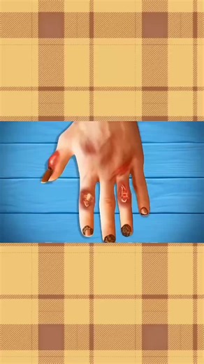 hand treatment cleaning asmr animation#hand #treatment #cleaning #asmr #vairalvideo