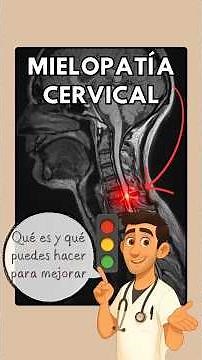 ¿Dolor cervical con torpeza o inestabilidad? Aprende a reconocer señales de la mielopatía cervical.
