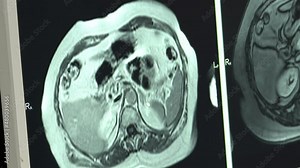 MRI scan screen animation. Computed medical tomography MRI. Diagnosis medical data