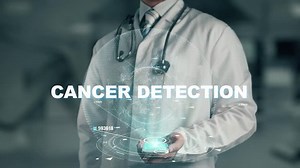 Doctor Holding Hand Cancer Detection Stock Footage Video (100% Royalty-free) 1012728707 | Shutterstock