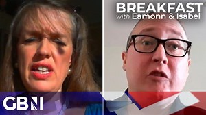 20mph speed limits: Are they actually any safer? - The Global Herald