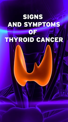 413K views · 866 reactions | A medical oncologist weighs in on the thyroid cancer symptoms to never ignore. | Northwestern Medicine | Facebook