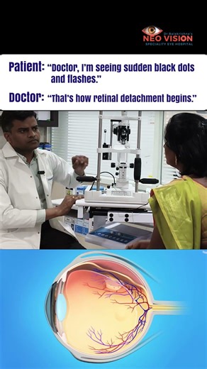 This Is How Retinal Detachment Begins | Don’t Ignore These Eye Symptoms #ytshorts #youtube #eyecare