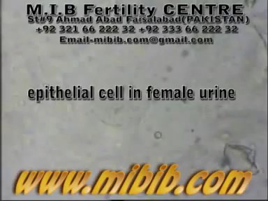 Normal Range of Epithelial Cells in Urine (High HPF in Urine Test Means?) - Healthrave