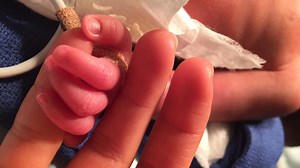 Congenital heart defects: What every parent should know