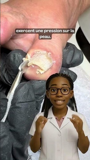 Tu savais que certaines déformations des ongles peuvent causer des douleurs intenses ?