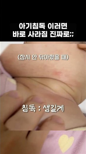 How to manage your baby's diarrhoea #parenting