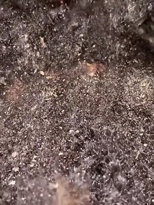 Dandruff asmr scratching removal on head using combing | Entertainment