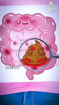 Early Signs Of Colorectal Cancer | Dr Asit Arora