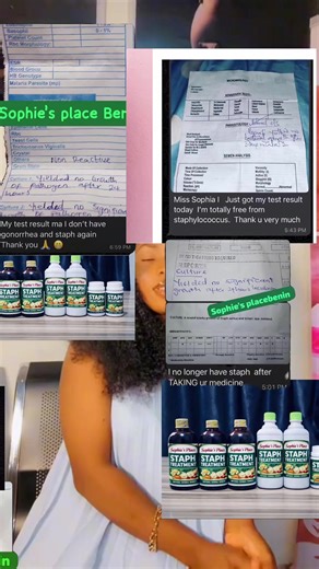 Signs youshouldn’t ignore painful boil,repeated skin infection,slow wound healing. These could be linked to staph infection Early attention makes a big difference Message me now to learn what to do next