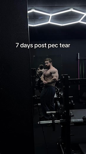 Fastest Recovery from Pec Tear in Bodybuilding