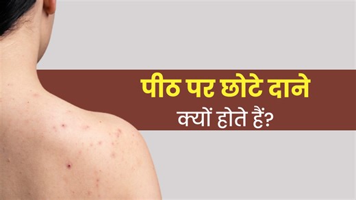 पीठ पर छोटे दाने क्यों होते हैं? जानें इसका कारण और बचाव