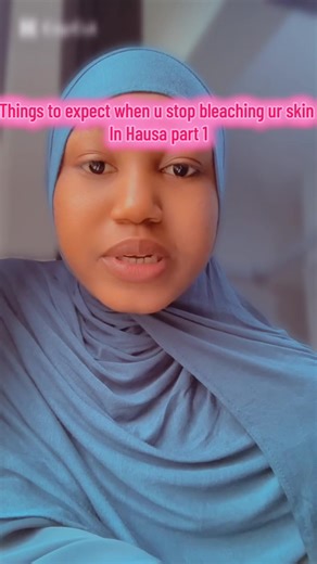 Some things to expect when u stop bleaching ur skin in Hausa. #skincarevendor #inaccra #tomyzongogirls #fyp