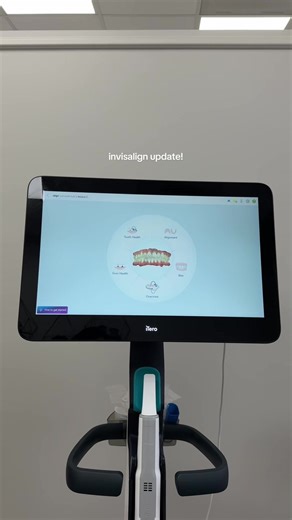 My Year-Long Invisalign Journey: Updates and Reflections