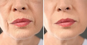 Voici les MEILLEURES astuces pour effacer les rides autour des lèvres, selon les experts