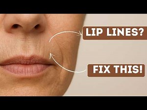 Smooth Lip Lines in 14 Days – No Botox, Real Results