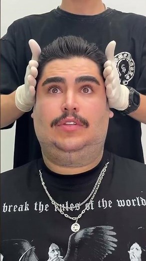 Watch: Discover the V-Line technique designed to enhance the appearance of the jawline